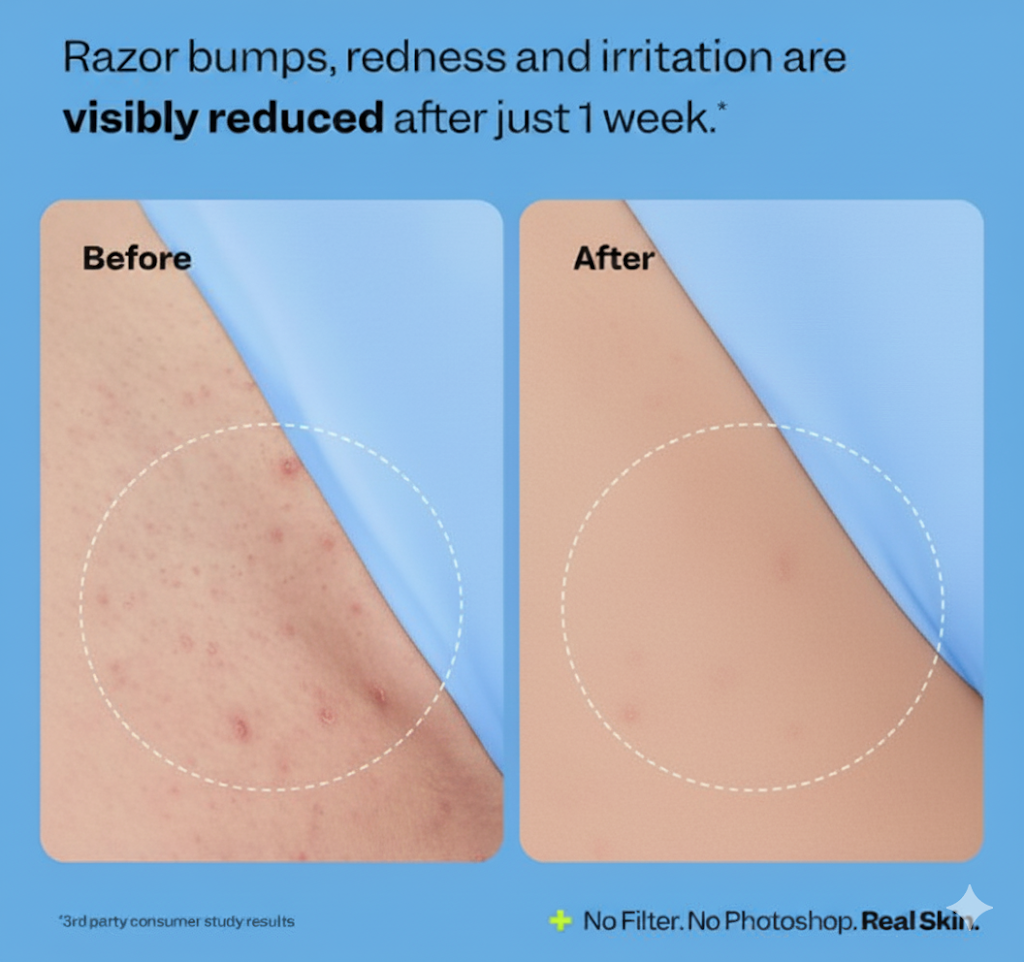 Peach Smoothing Solution - Ingrown Hair Treatment