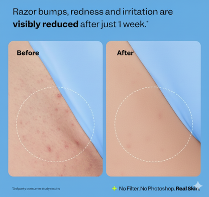 Peach Smoothing Solution - Ingrown Hair Treatment